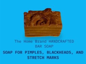 Soap pimples , blackheads , and stretch marks
